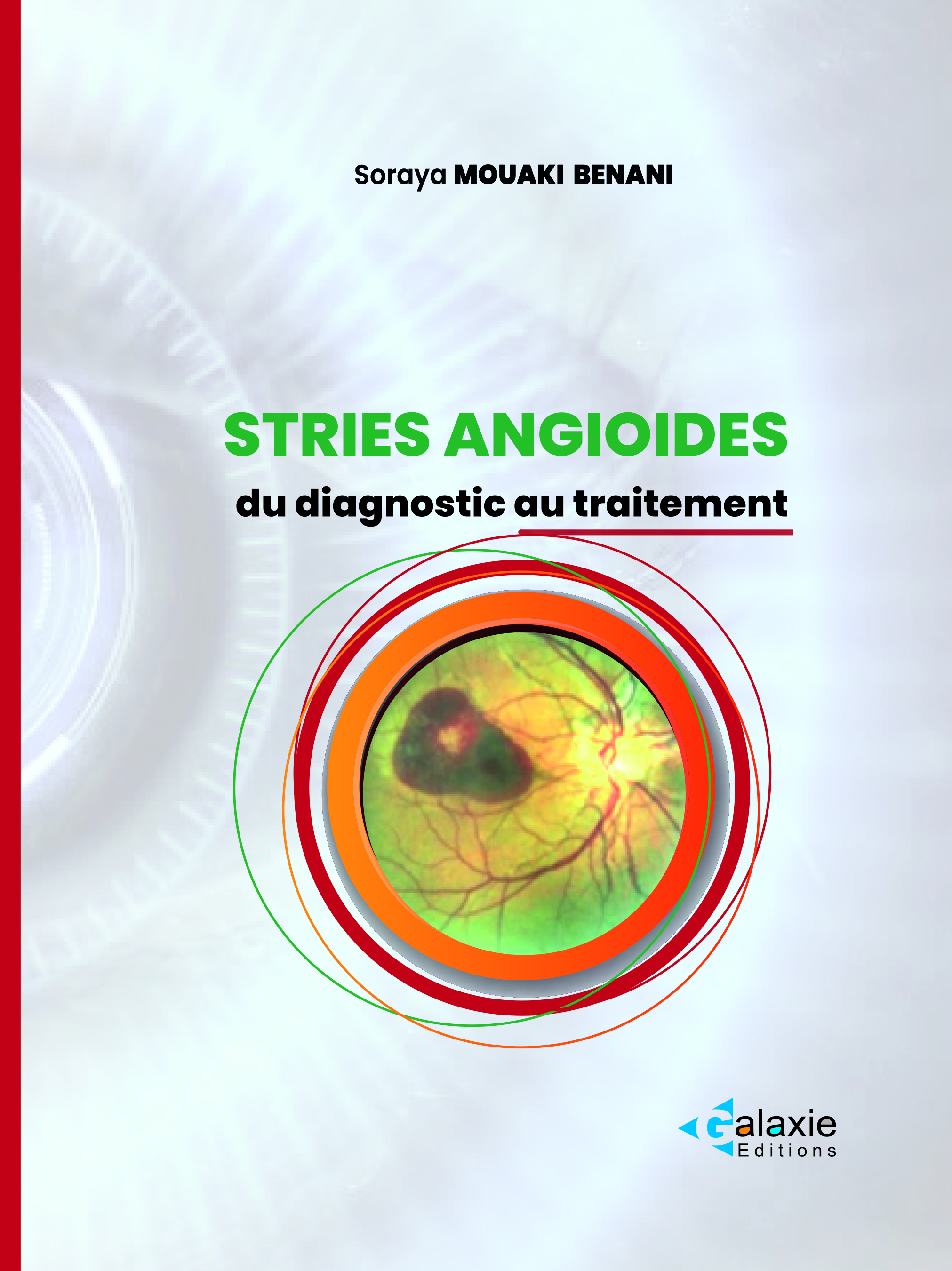 STRIES ANGIOÏDES du Diagnostic au Traitement